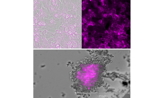 Figure 1. 2D (top) and 3D (bottom) hIPSC-cardiomyocytes labeled with BeRST voltage sensitive dye. CMs imaged at 20x or 10x magnification, respectively. Scale bar applies to bottom image.