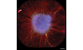 Figure 1. Full well acquired by TARGA showing radial organization of organoid. Scale bar is 0.2 mm. Image by Sakshi Bansal