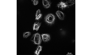  In vitro, cultured cardiomyocyte spheroids 