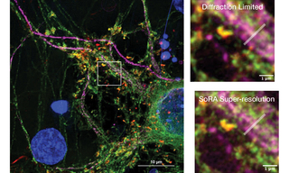 Cultured mouse neurons 
