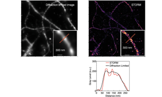 Actin, spectrin and associated molecules form a membrane-associated periodic skeleton that plays an important role in the regulation of neuronal function and dysfunction. 
