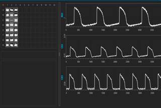 VOLTA software displays fluorescence waveforms of 2D and 3D hIPSC-CMs collected on the VOLTA Scanner at 10 kHz sampling rate over time. Fluorescence of BeRST voltage sensitive dye excited by 660 nm light reporting changes in transmembrane action potential for 2D (well B02) and 3D (wells C02 and C03) hIPSC-CMs at two cell densities (10,000 cells / C02; 20,000 cells / C03).
