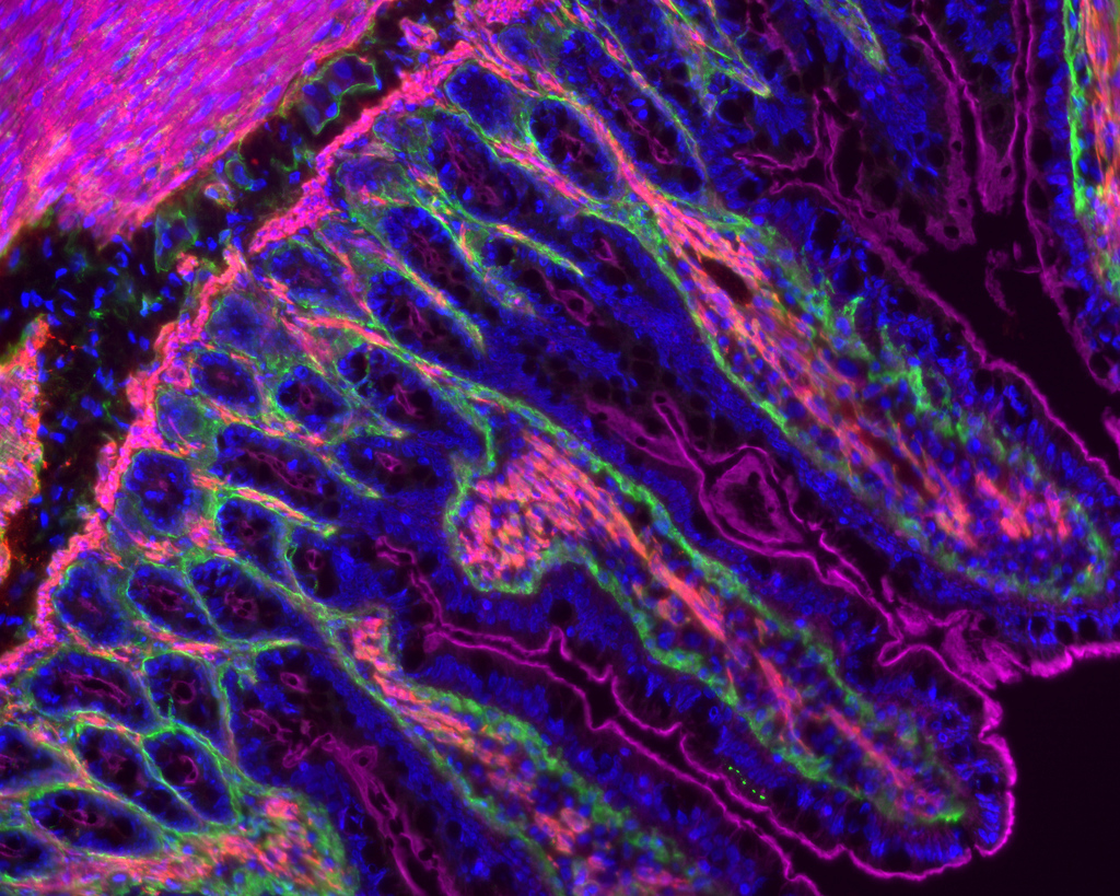 Lumencor | High-Performance, Solid-State Microscope Lighting