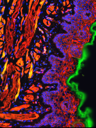Life sciences application imagery: Cell captured in green, yellow, black, pink.