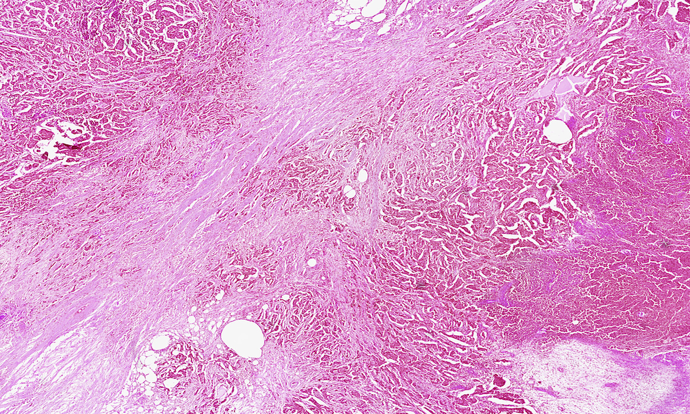 Advancing Bioanalysis with Solid-State Microscope Lighting