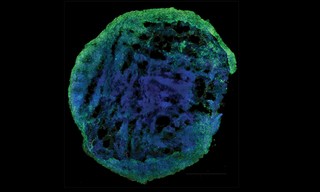 Brain Organoid

50 micro thick slice cut from a brain organoid structure derived from induced pluripotent stem cells

Microscope: Nikon Ti2
Objective: Nikon 60X oil Plan Apo Lambda, NA 1.4
SD confocal module: Crest X-Light V3 
Confocal Laser bank: Lumencor CELESTA Light Engine

Staining: 
•	Magenta: TBR1 stained with Alexa 750. TBR1 is a transcription factor important for the differentiation of the nuclear glutamatergic neurons during cortical development. Staining specific for layer VI neurons.
•	Green: MAP2 stained with Alexa 488.  MAP2 is a protein associated with the microtubules present in the cytoskeleton of the neuronal dendrites.
•	Blue: DAPI