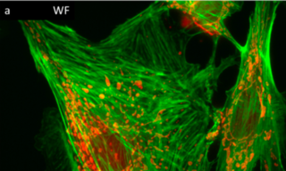 100X widefield (a) and structured illumination microscopy (b) images of actin (green) and mitochondria (orange) in fixed bovine pulmonary endothelial cells. From Pospíšil et al, GigaScience (2018) 8:1–12