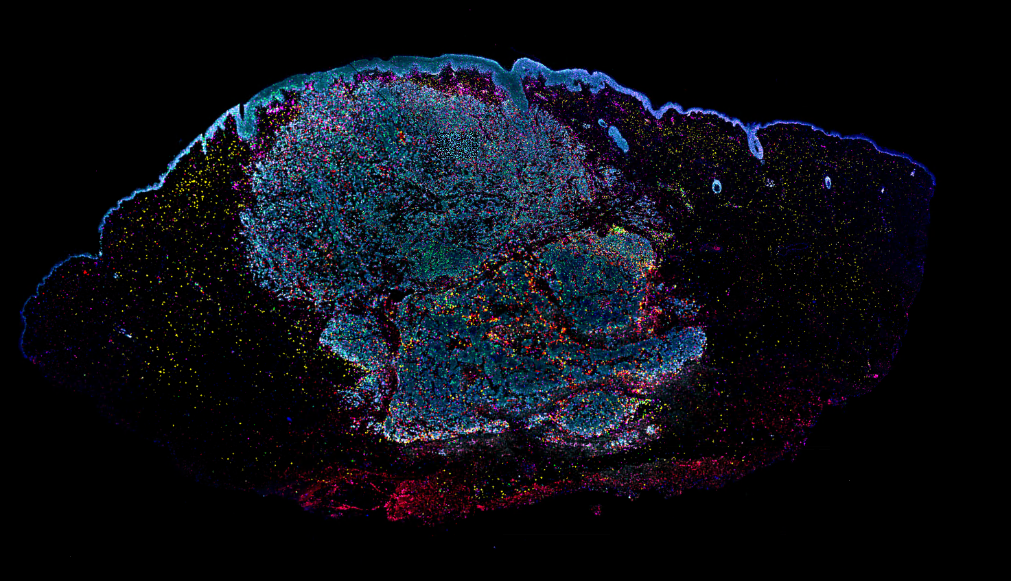 Lumencor | Solid-State Light Sources for Microscopy & More