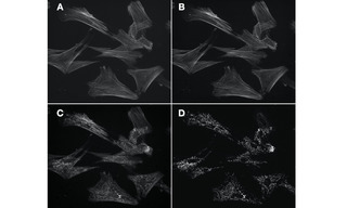 Figure 2. Figure 2. Four 60X fluorescence images of the same field of muntjac skin fibroblasts, labeled with Alexa Fluor 488 phalloidin (actin) and mouse anti–OxPhos Complex V + Alexa Fluor 555 goat anti–mouse IgG (mitochondria). A. Image of actin cytoskeleton acquired using single-band excitation and emission filters and a single band dichroic beamsplitter. B. Equivalent image of actin cytoskeleton acquired using single band excitation and emission filters and multi-band dichroic beamsplitter. C. Image of actin cytoskeleton degraded by detection of mitochondria due to spectral crosstalk. Image acquired using single band excitation filter, multi-band dichroic beamsplitter and multi-band emission filter. D. Image of mitochondria acquired using single band excitation filter, multi-band dichroic beamsplitter and multi-band emission filter. Image is not degraded by crosstalk because the excitation bandwidth (555/28 nm) does not intersect the excitation spectrum of Alexa Fluor 488 to a significant extent. Images acquired using a Lumencor SPECTRA Light Engine, Andor Zyla 5.5 sCMOS camera and Nikon Ti2 microscope.