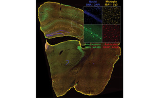 Figure 2. Four-color dual camera imaging of a fixed mouse brain slice. Image shows a maximum intensity projection composite of 8×9 acquisition tiles taken with a 20X NA 0.75 air objective with a 25 mm FOV Kinetix camera and a 15% tile overlap. Recorded on a Nikon Ti2 microscope equipped with a CrestOptics X-light v3 spinning disk confocal scanner, dual Teledyne Photometrics Kinetix sCMOS cameras, and a Lumencor CELESTA Light Engine.