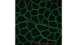 Immunofluorescence image showing normal dystrophin localization around the sarcolemma in human muscle biopsy tissue.  Scale bar = 100 µm. 